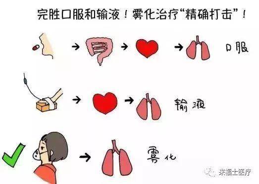 喷门迟缓症最新疗法研究与应用